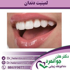 لمینیت-دندان