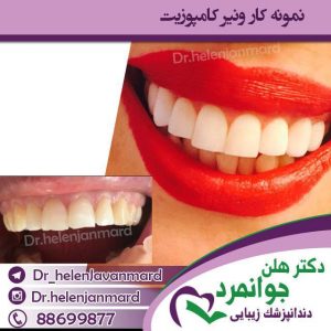 دندانپزشک کودکان (28)