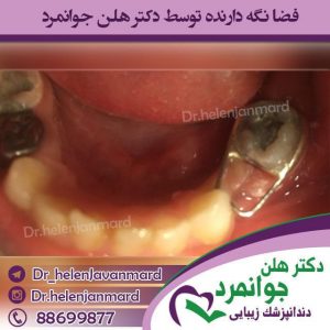 دندانپزشک-کودکان-2-2