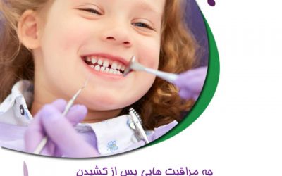 بعد از کشیدن دندان های شیری کودک، چه مراقبت هایی لازم است؟