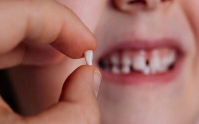 چرا باید از دندان های شیری مراقبت کنیم ؟