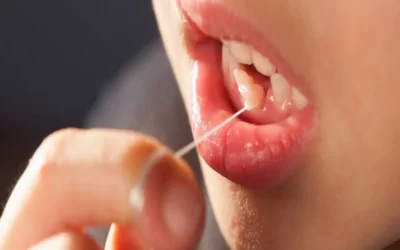 کشیدن دندان شیری لق